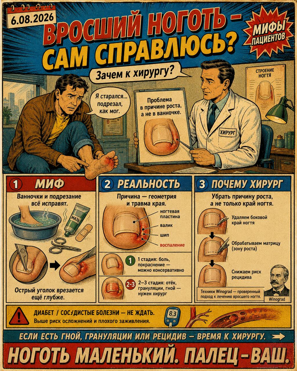 Мифы пациентов │ Вросший ноготь — сам справлюсь, зачем к хирургу?