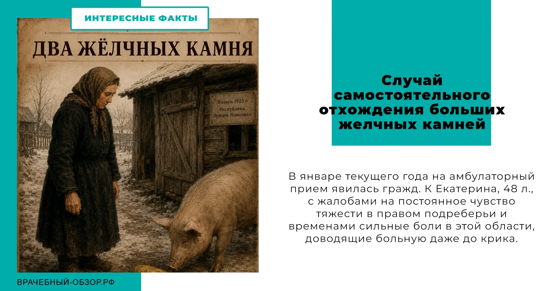 Случай самостоятельного отхождения больших желчных камней