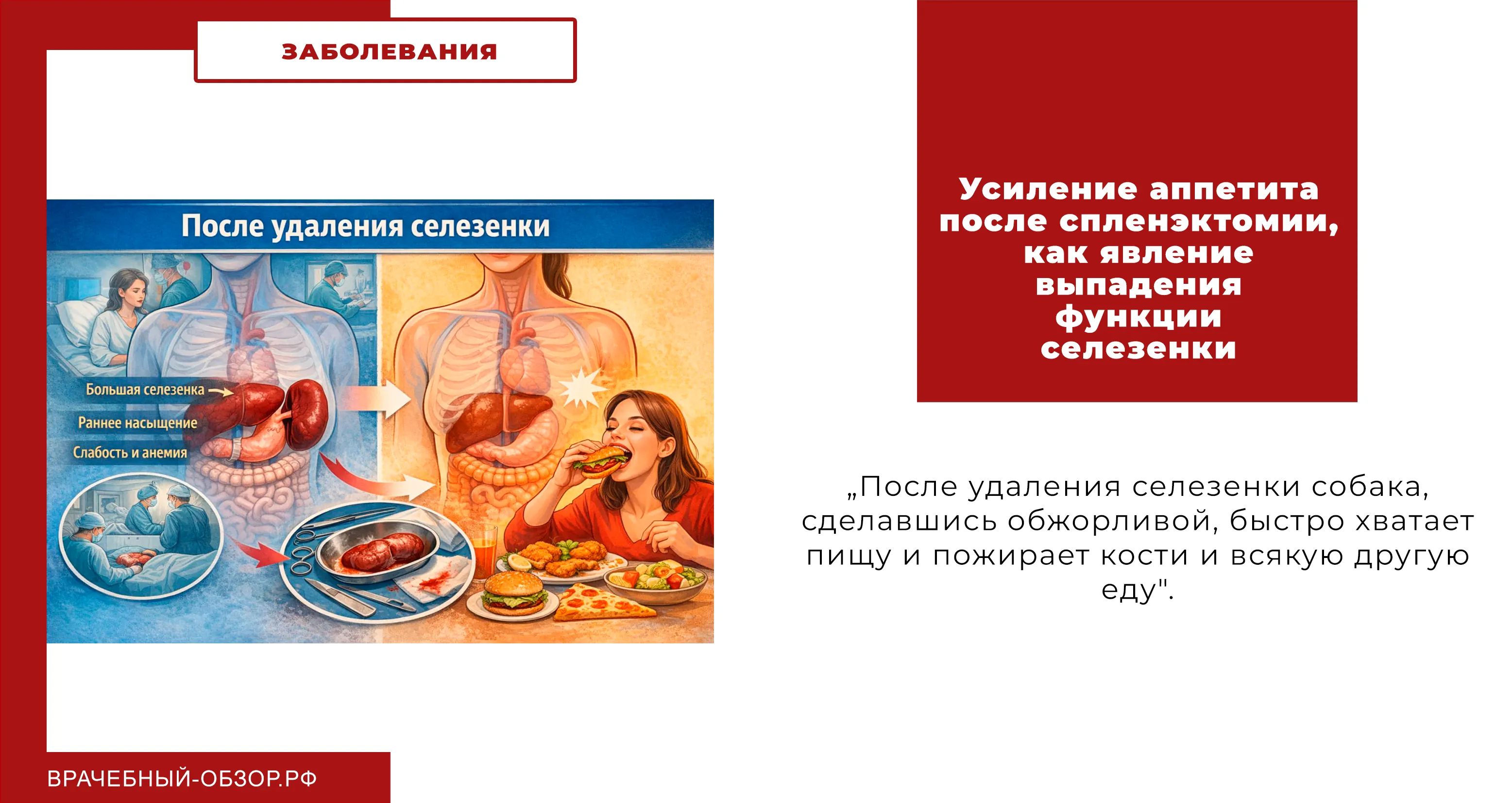 Усиление аппетита после спленэктомии, как явление выпадения функции селезенки