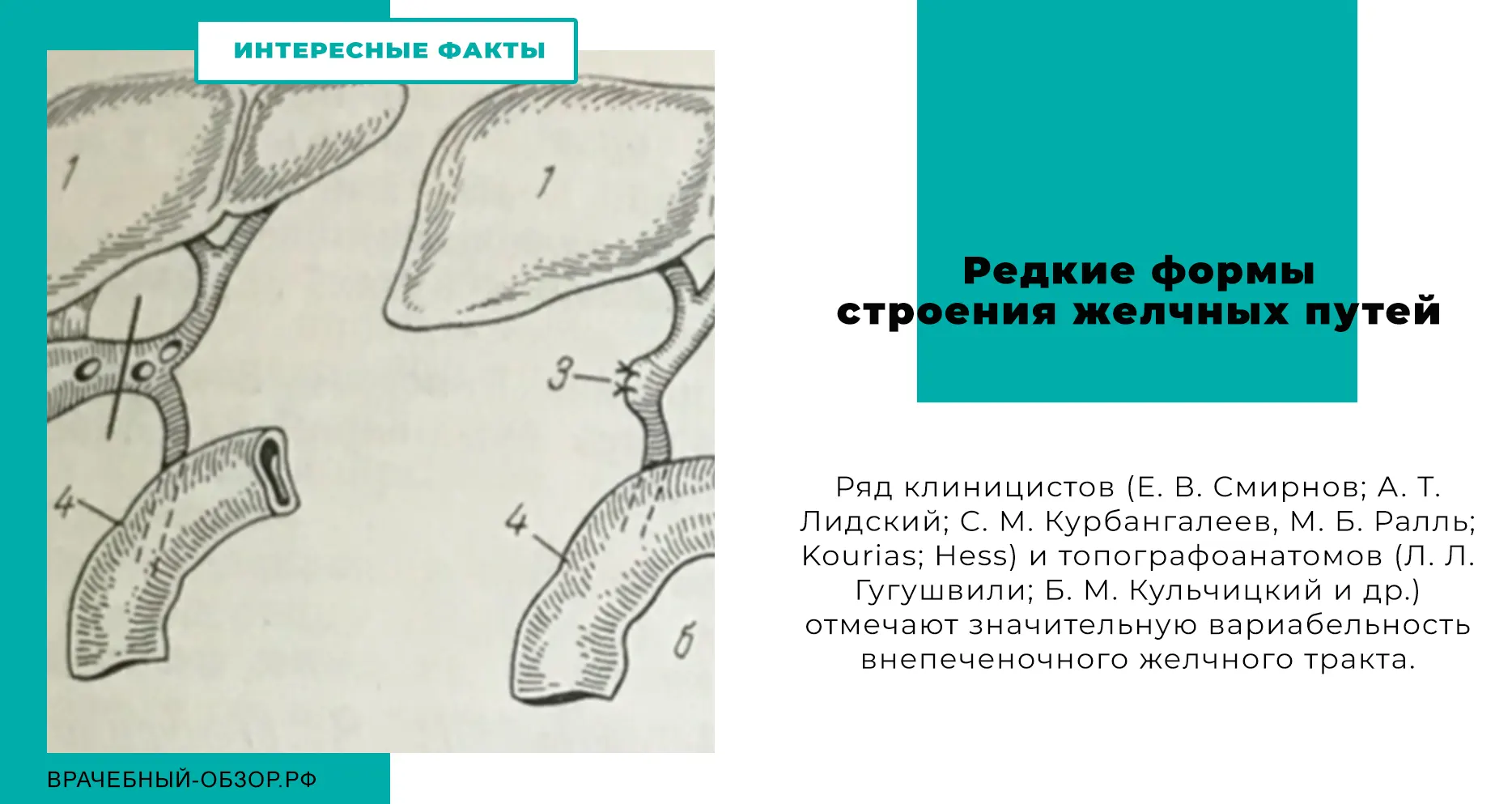 Редкие формы строения желчных путей
