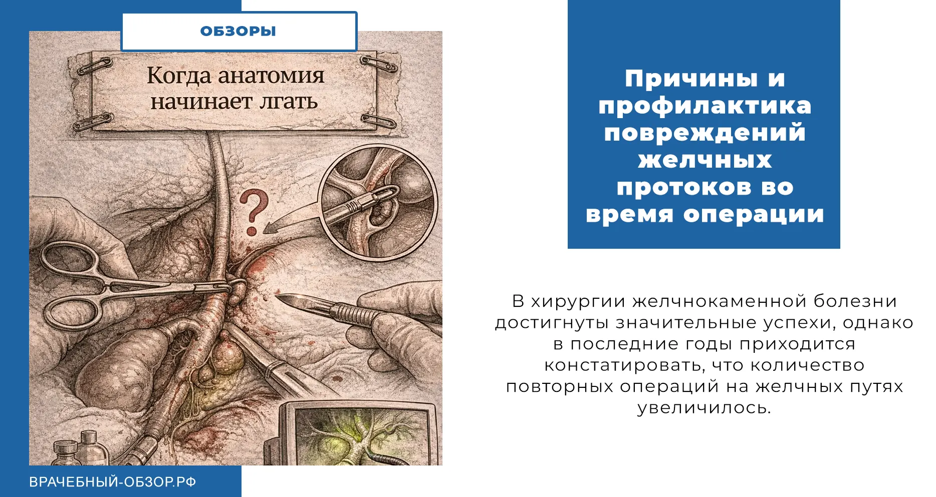 Причины и профилактика повреждений желчных протоков во время операции
