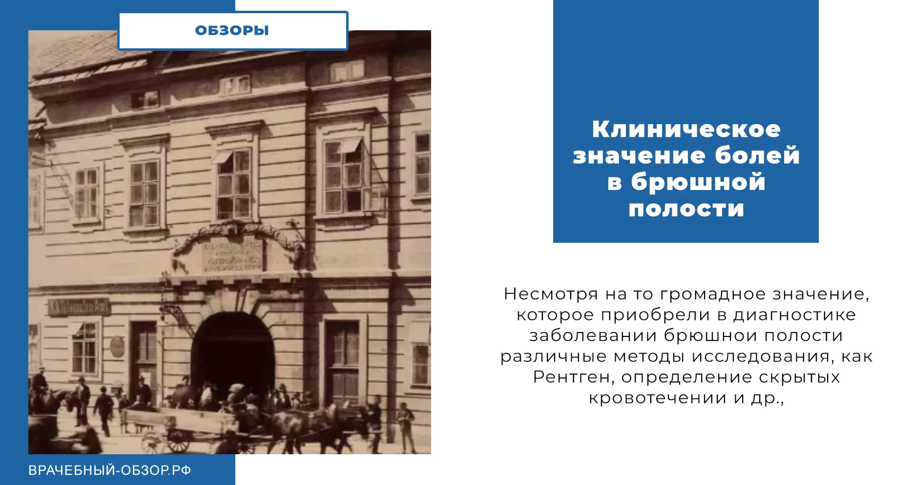 Клиническое значение болей в брюшной полости