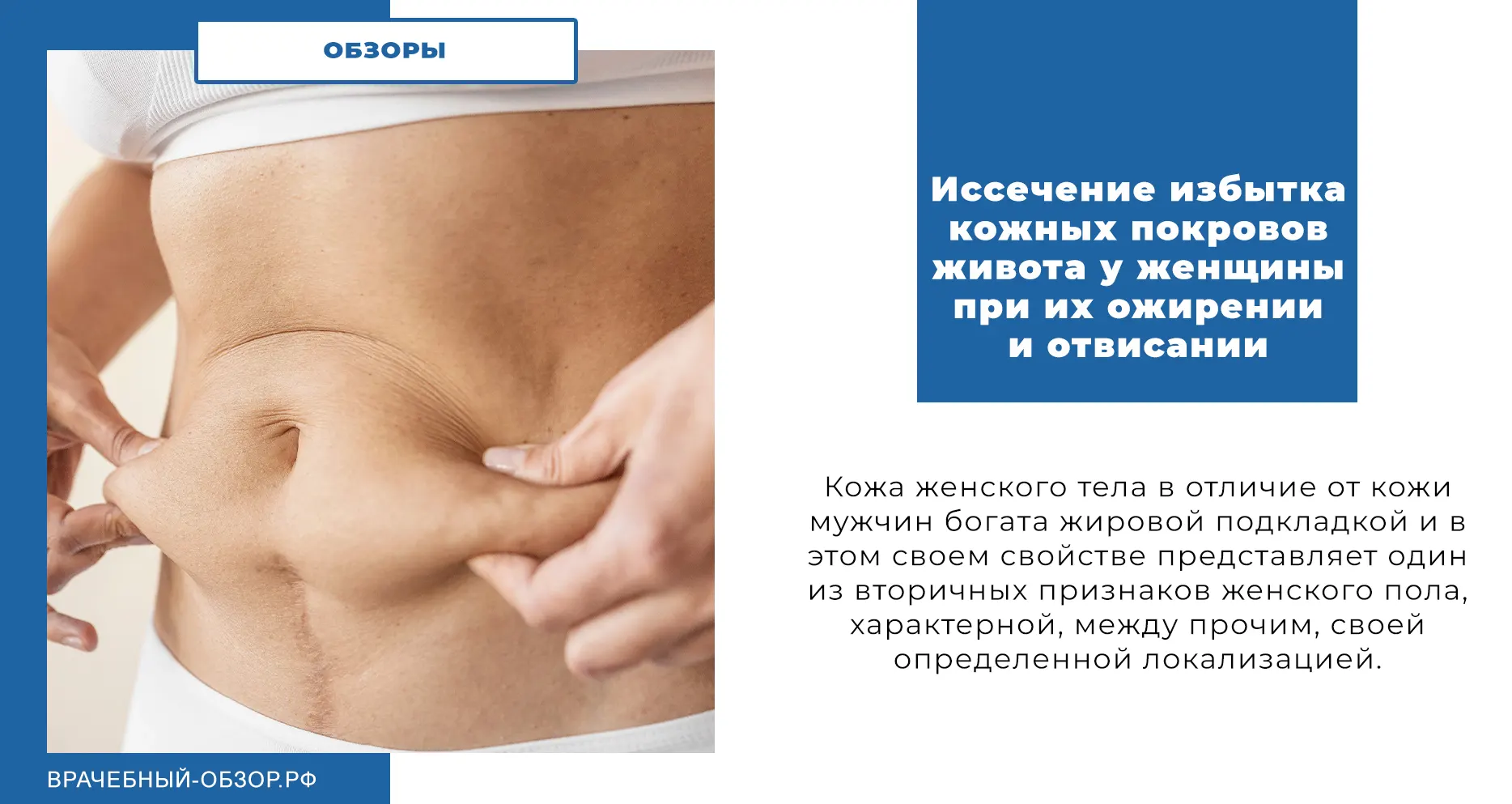 Иссечение избытка кожных покровов живота у женщины при их ожирении и отвисании