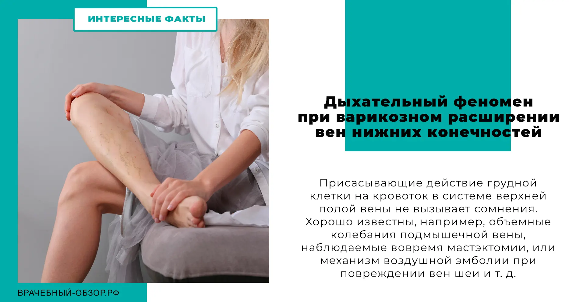Дыхательный феномен при варикозном расширении вен нижних конечностей