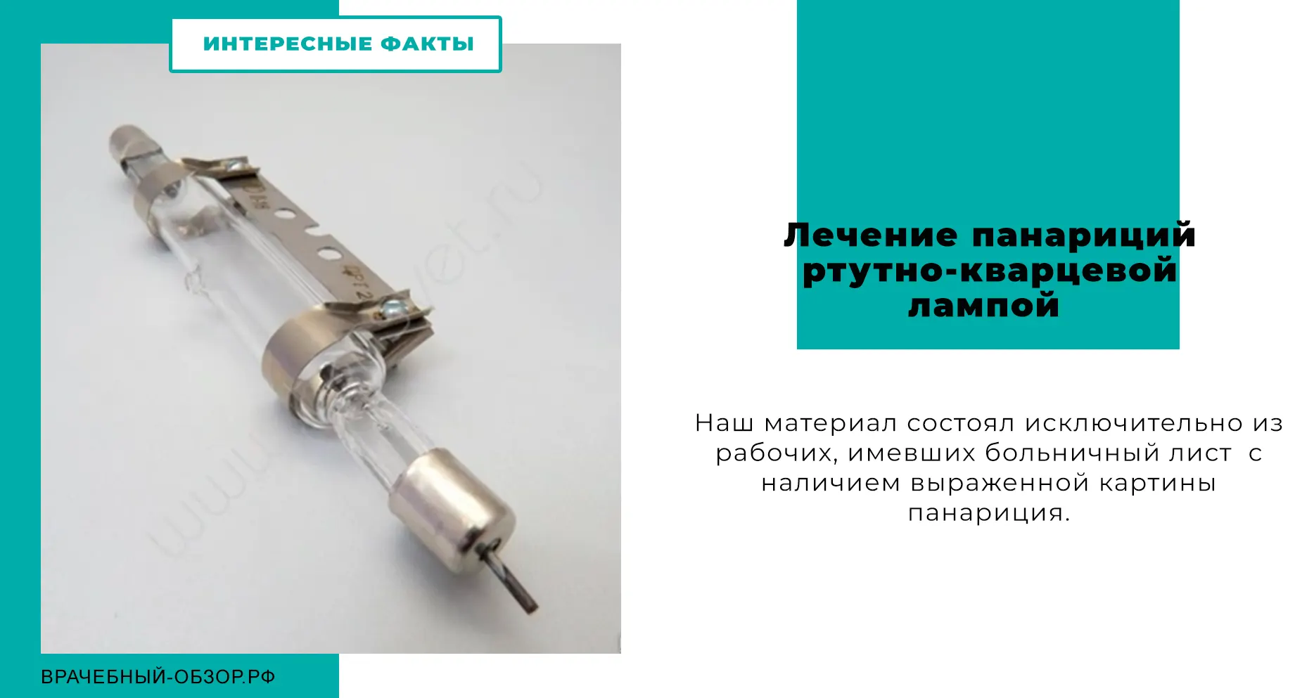 Лечение панариций ртутно-кварцевой лампой