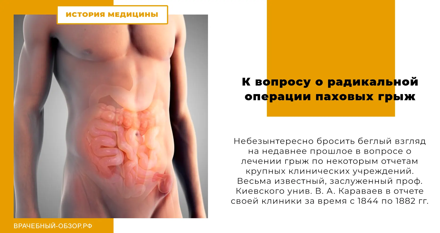 К вопросу о радикальной операции паховых грыж