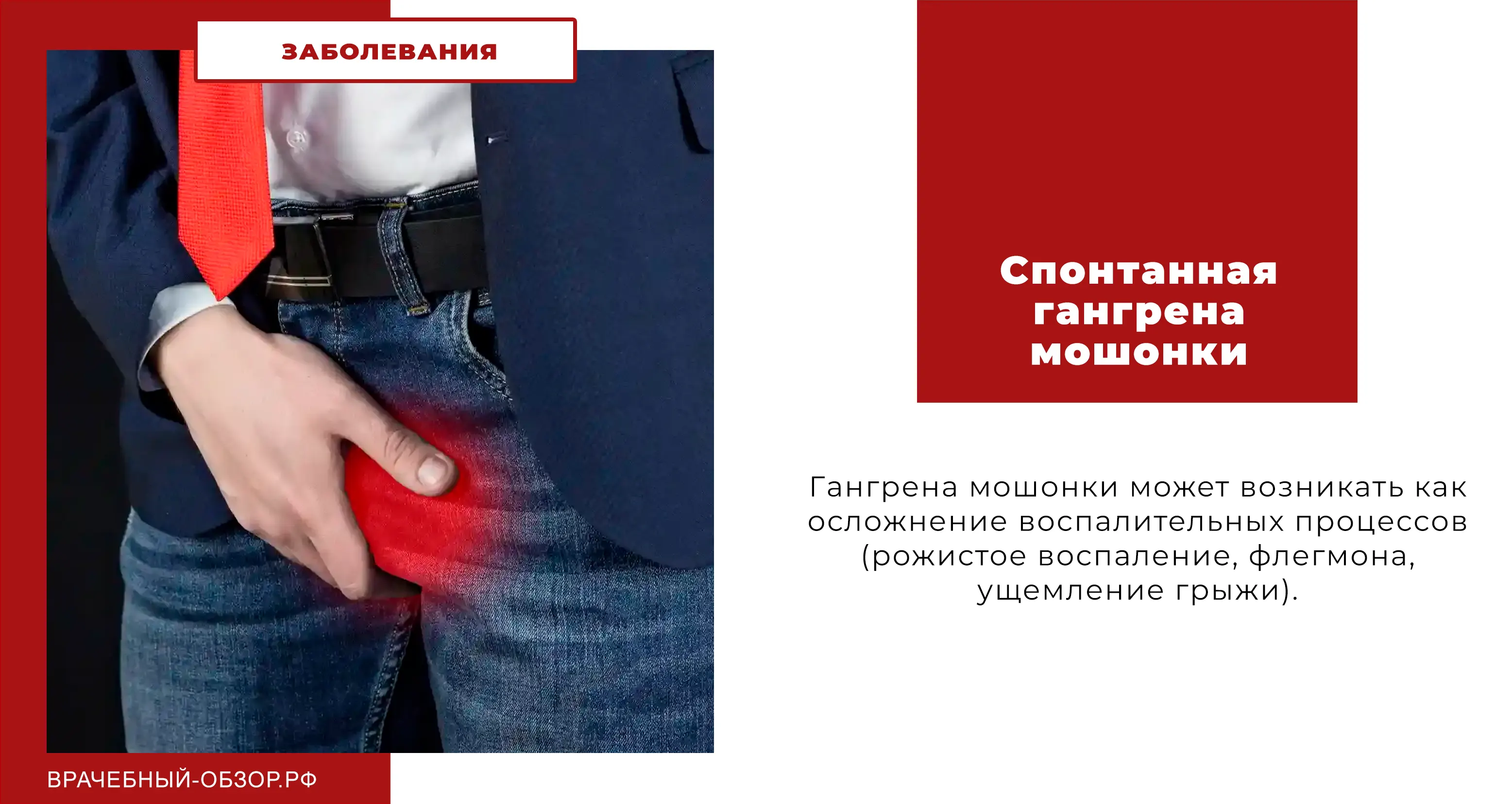 Спонтанная гангрена мошонки