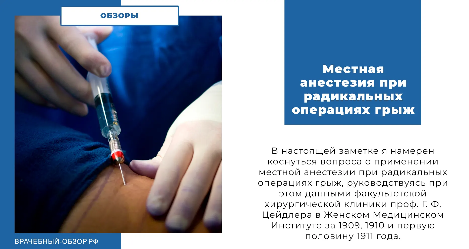 Местная анестезия при радикальных операциях грыж