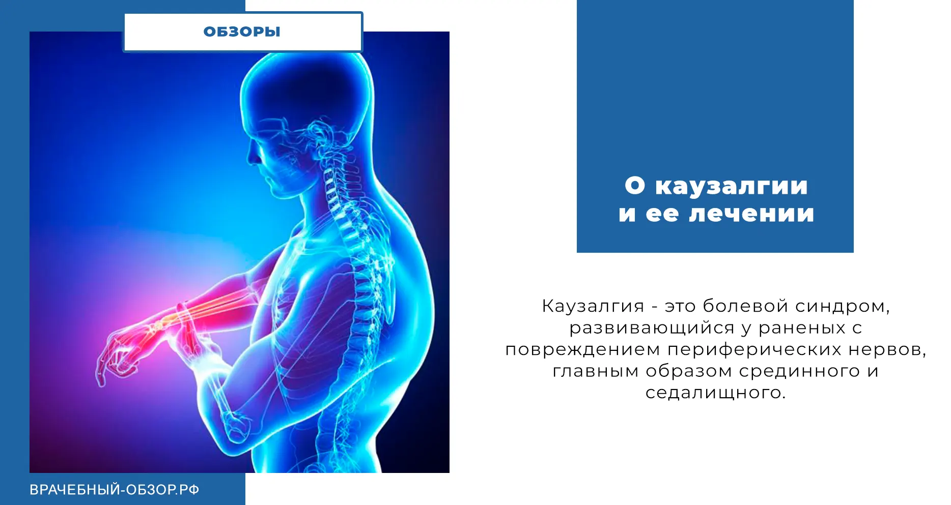 О каузалгии и ее лечении