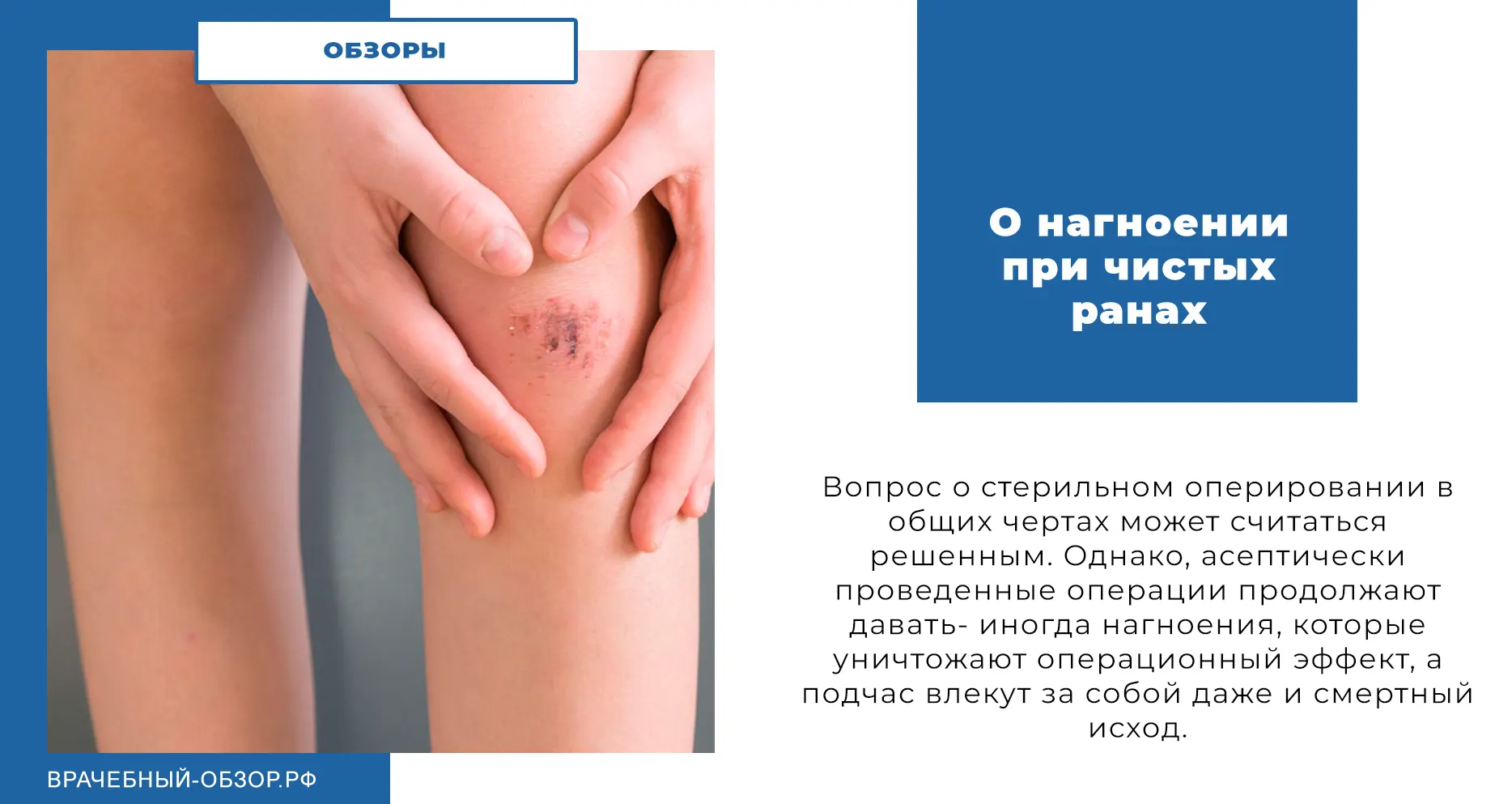 О нагноении при чистых ранах