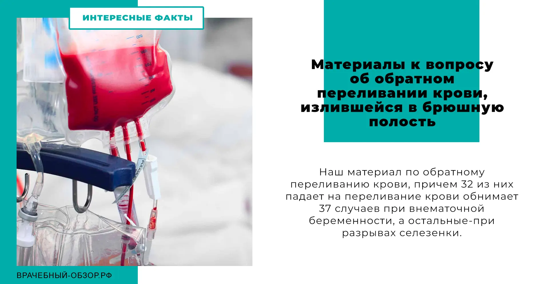Материалы к вопросу об обратном переливании крови, излившейся в брюшную полость