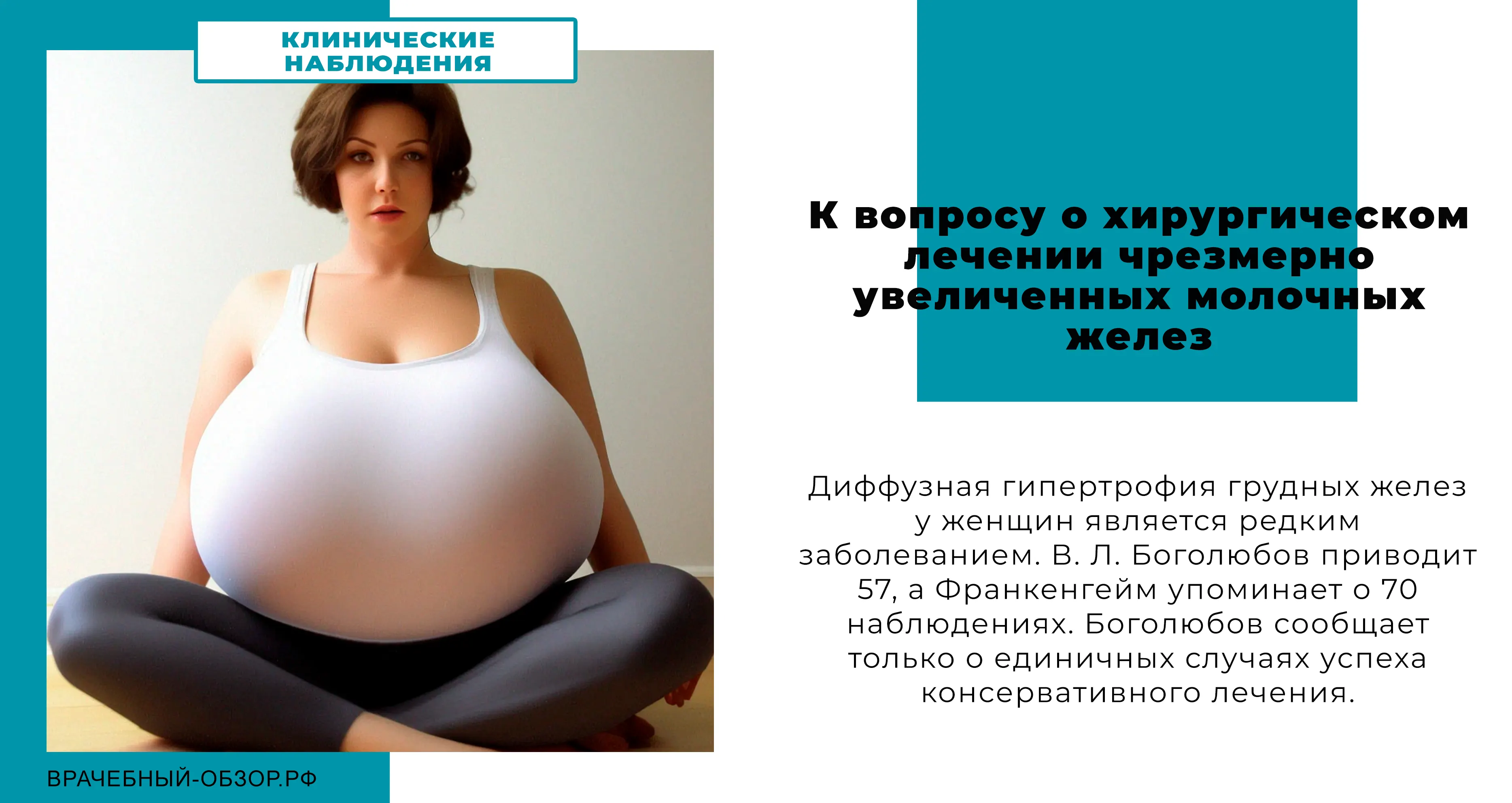 К вопросу о хирургическом лечении чрезмерно увеличенных молочных желез