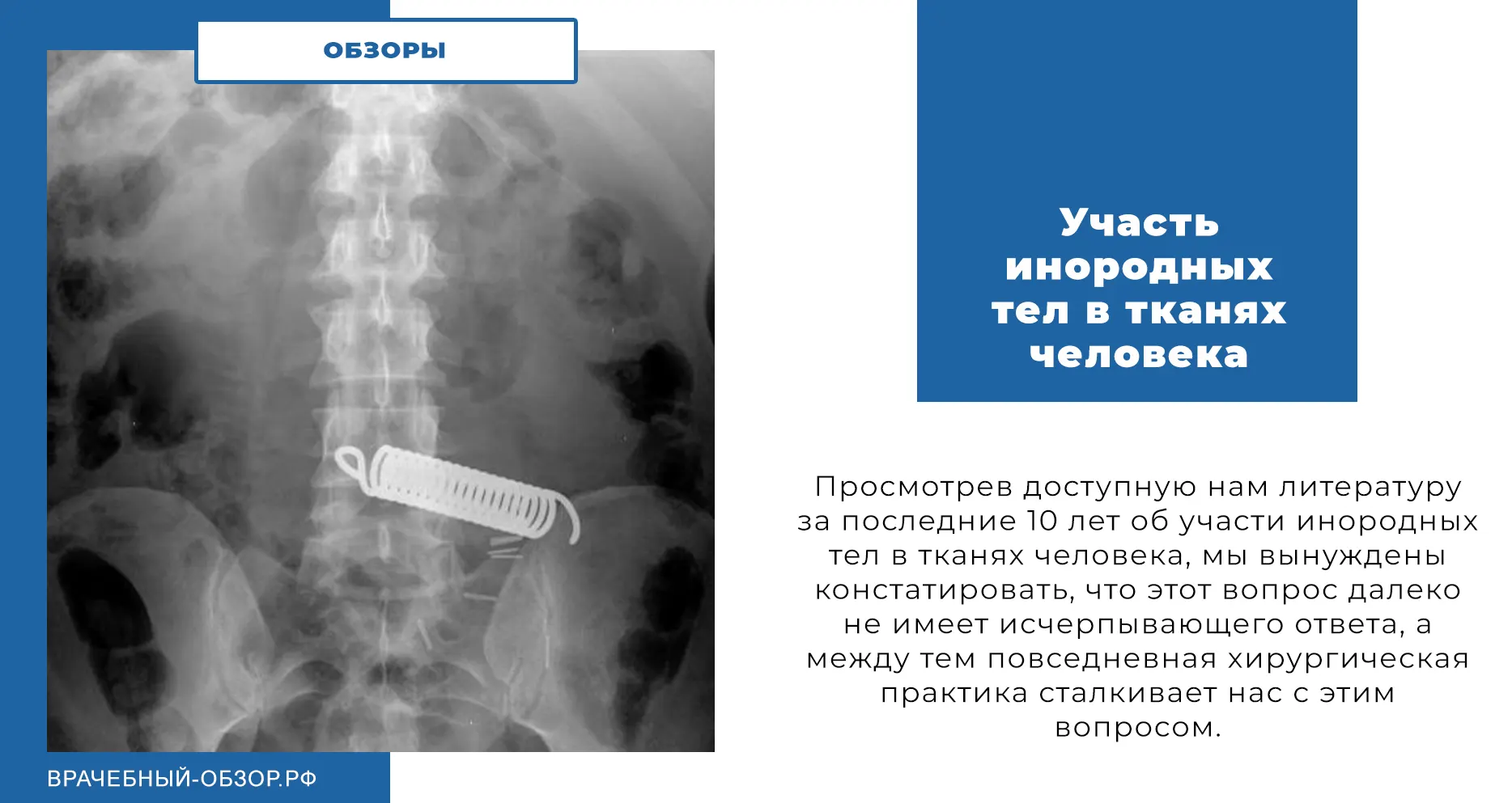 Участь инородных тел в тканях человека