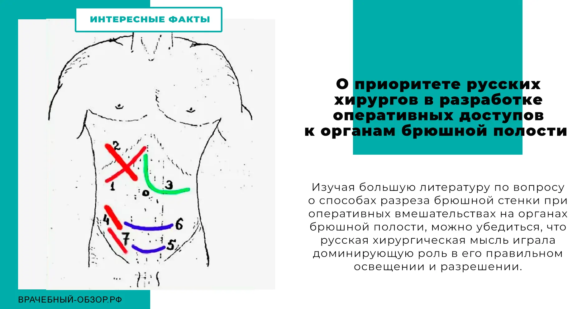 О приоритете русских хирургов в разработке оперативных доступов к органам брюшной полости