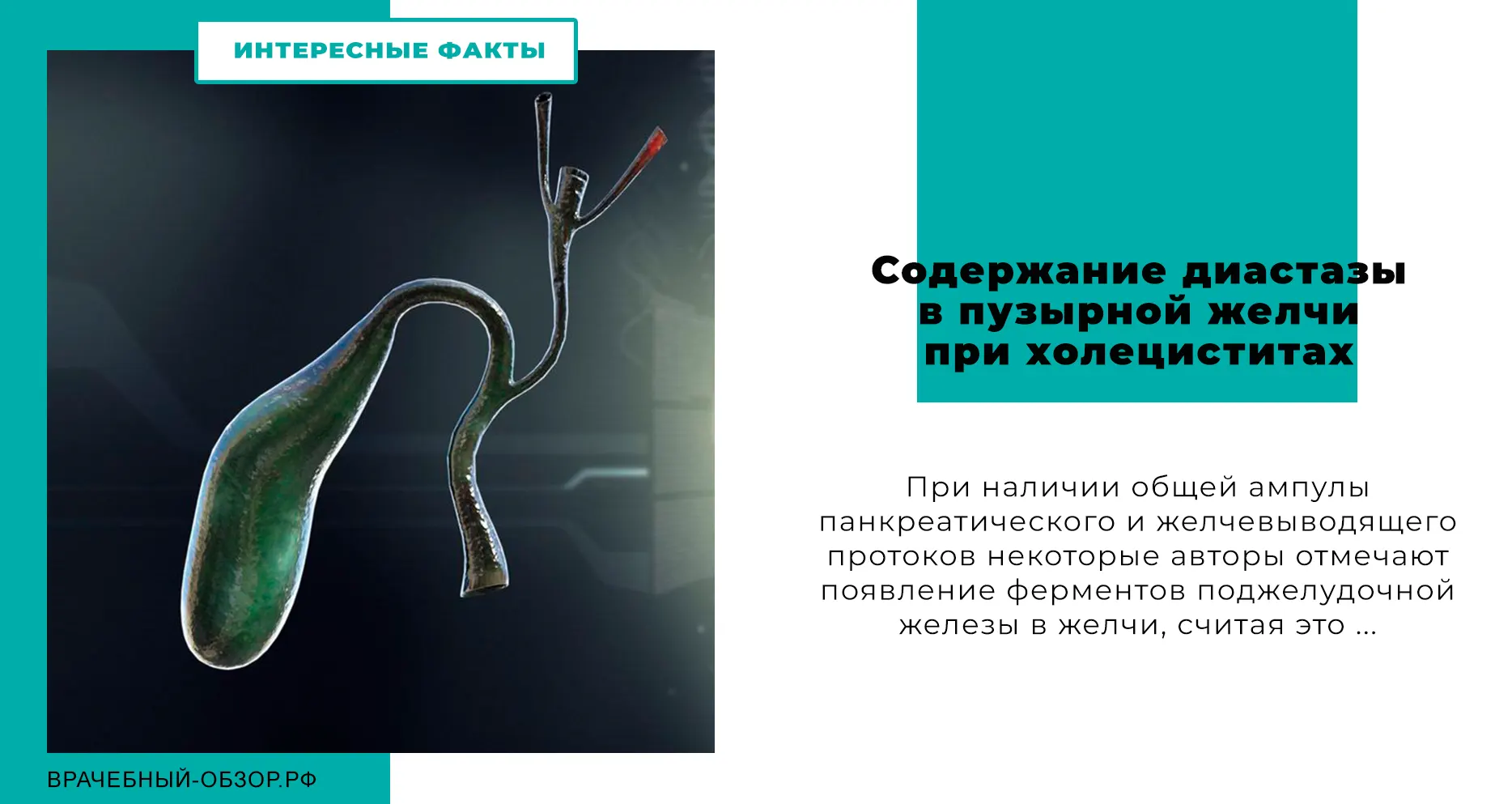 Содержание диастазы в пузырной желчи при холециститах