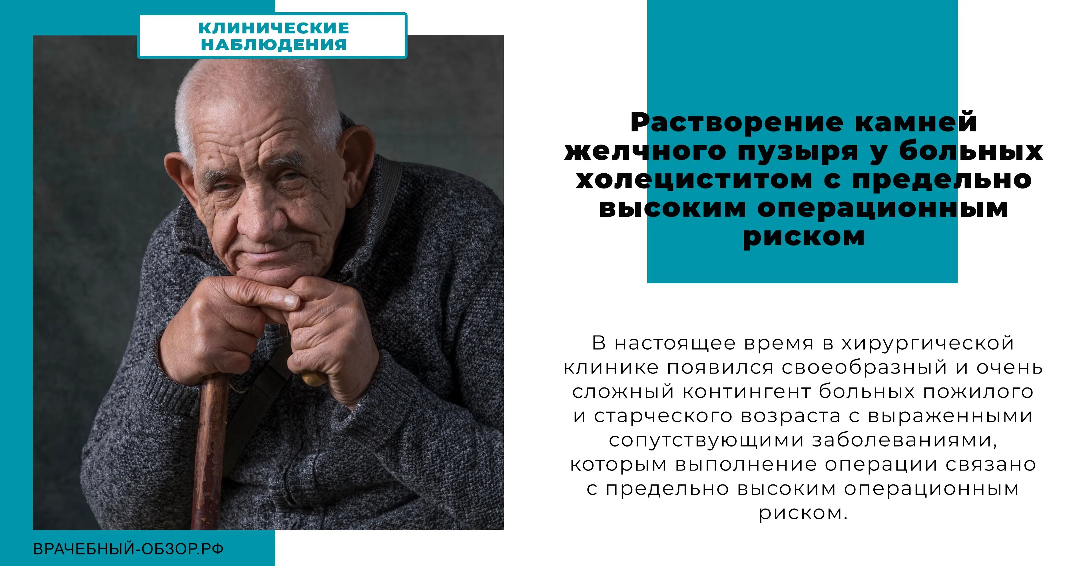 Растворение камней желчного пузыря у больных холециститом с предельно высоким операционным риском