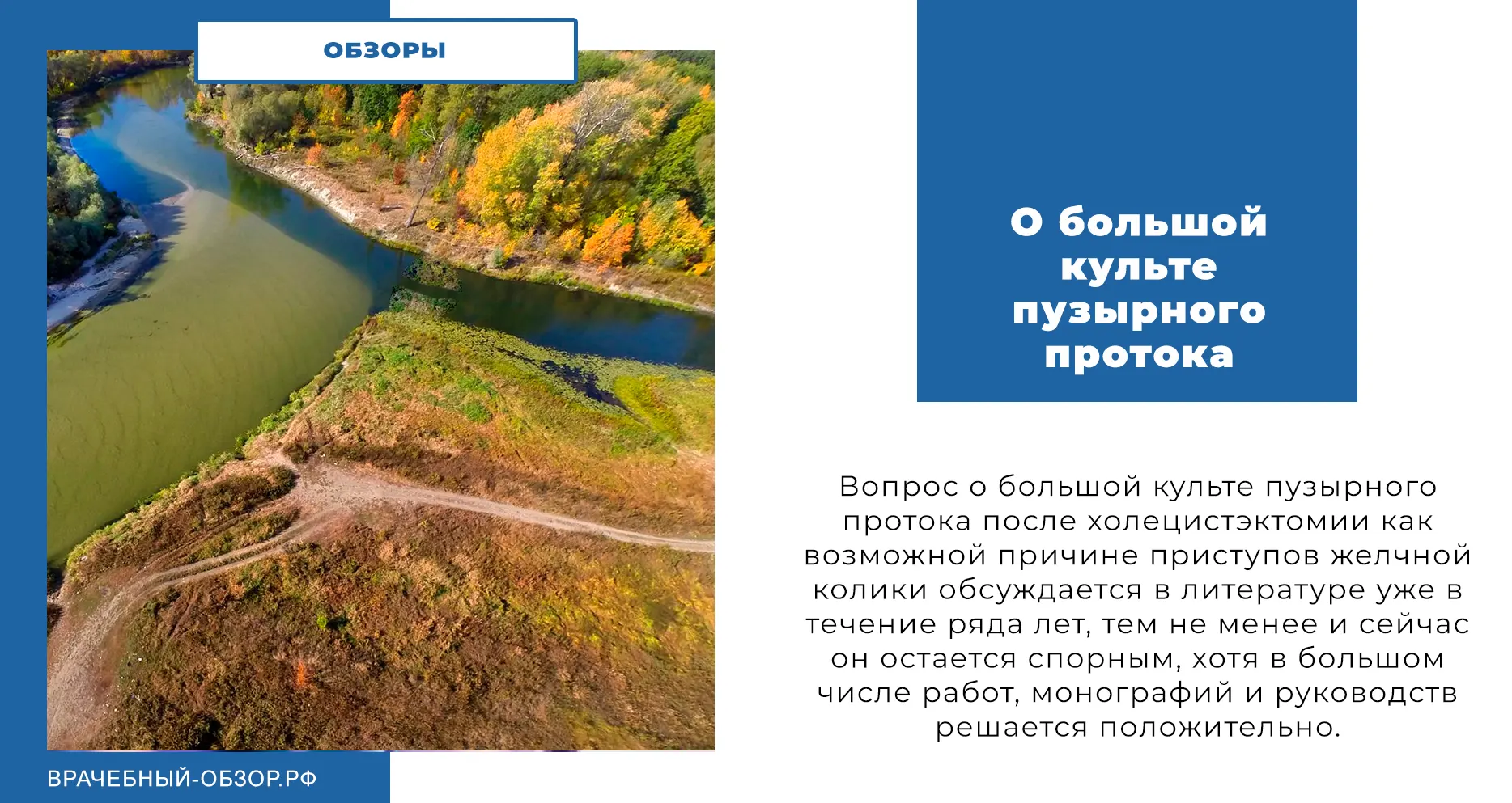 О большой культе пузырного протока