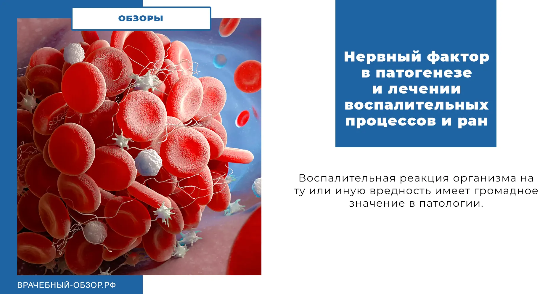 Нервный фактор в патогенезе и лечении воспалительных процессов и ран