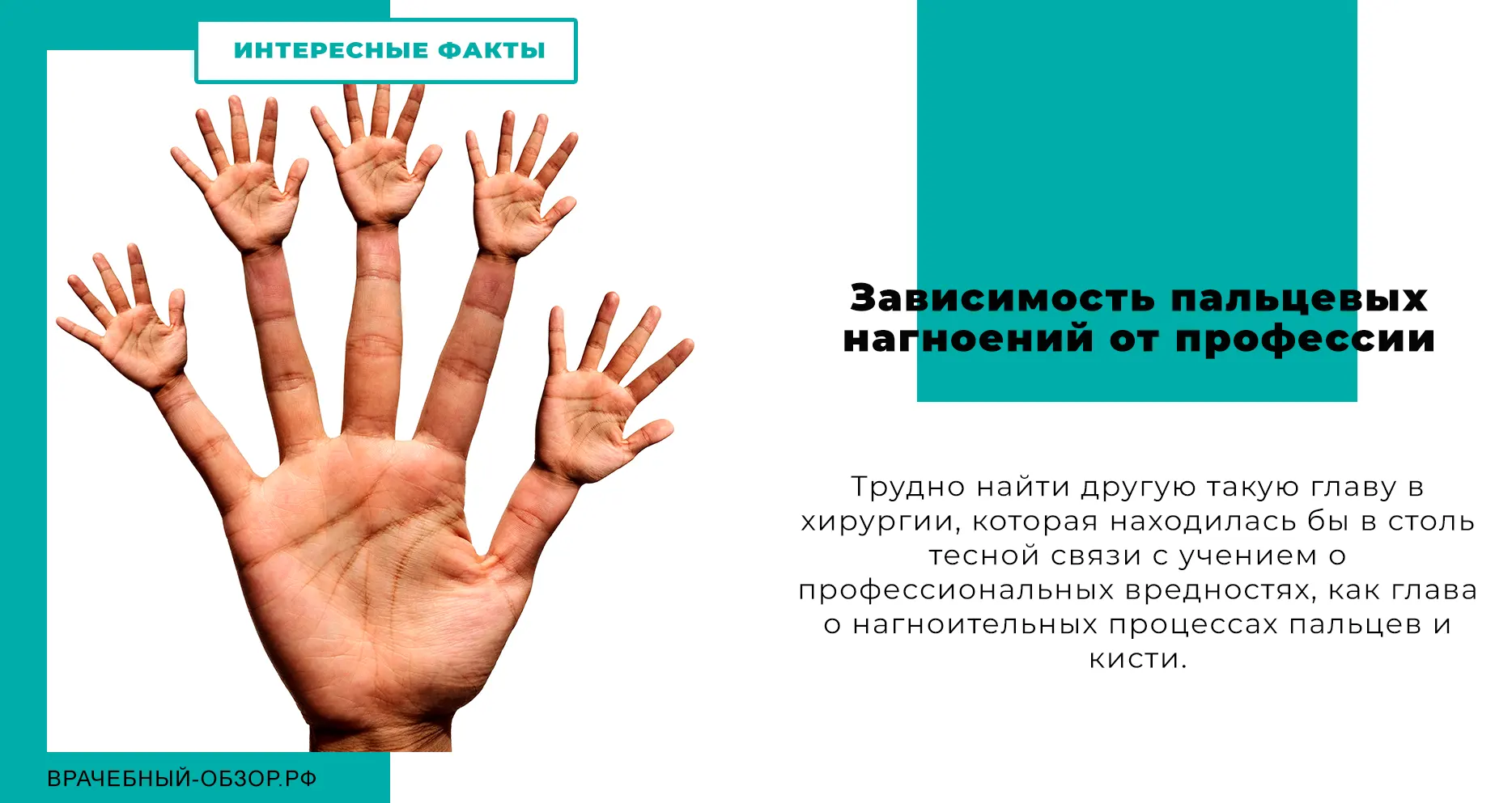 Зависимость пальцевых нагноений от профессии